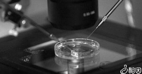 卵细胞内单精子显微注射技术