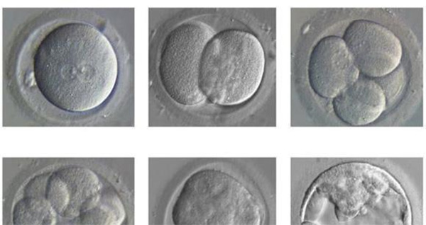 试管囊胚培养发育情况