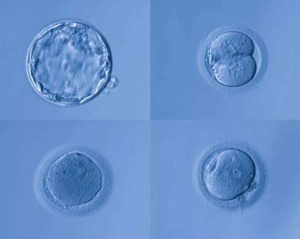 胚胎培养