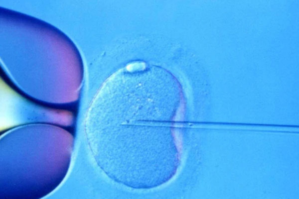胚胎筛查时间大概要14天左右