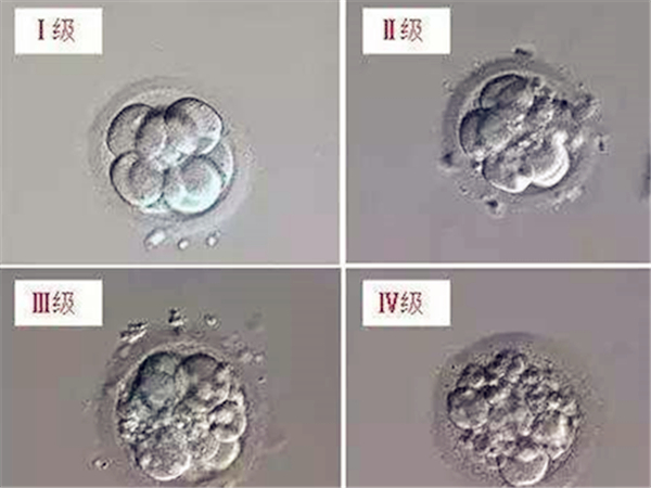 中信湘雅有4BC囊胚成功移植的案例