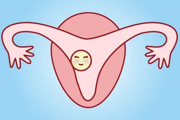 子宫畸形会影响生育能力