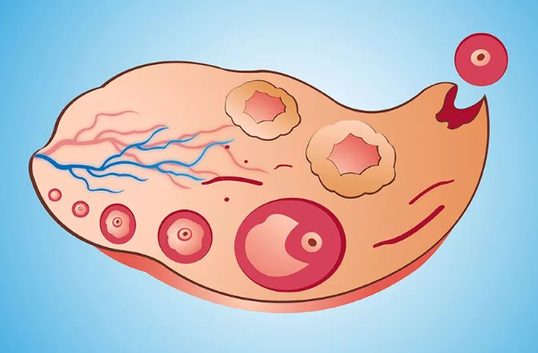 卵泡发育慢可能是内分泌有问题