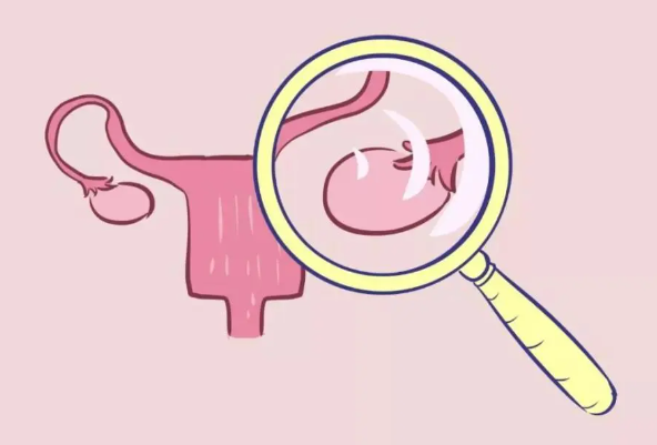 卵巢囊肿是女性常见肿瘤疾病
