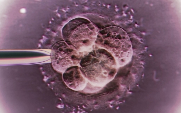 A级胚胎移植成功概率高