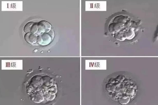 一级胚胎是最优质的