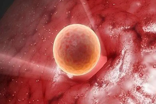 囊胚移植可以提高妊娠率