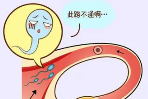 输卵管堵塞会导致久备不孕