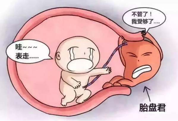 胎盘早剥会导致胎儿缺氧死亡
