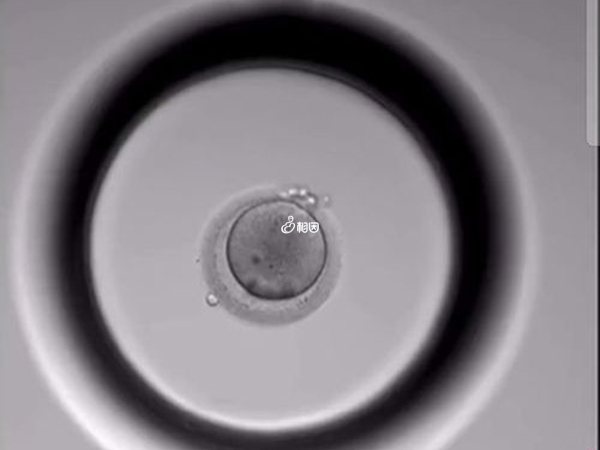 胚胎养囊后需要用PGS或PGD技术进行筛查