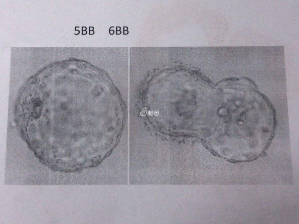 胚胎不同成功率不同