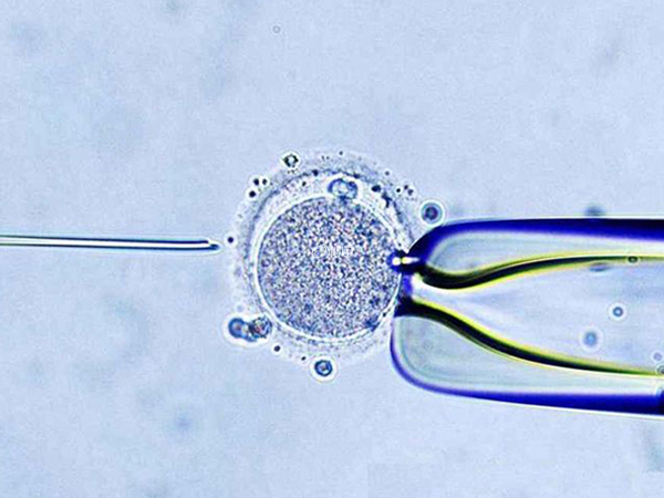 二代单精子注射可提高受精率