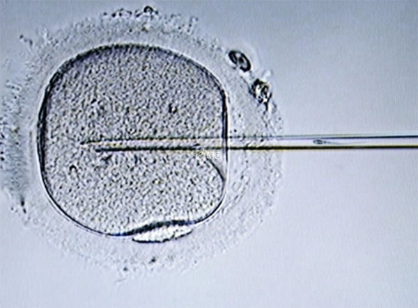 移植一枚男囊胚成功怀孕