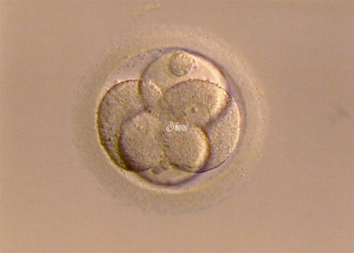 卵子受精后不分裂可以做第四代试管婴儿