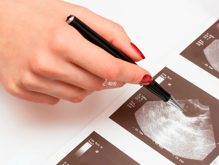正常的子宫环境有利于胚胎着床