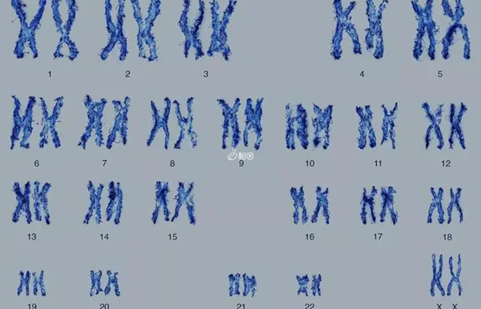 pgd技术可实现染色体非整倍体检测
