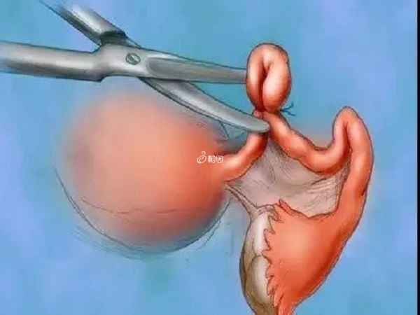 输卵管疏通手术一般需要5000-10000元