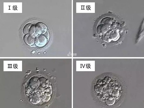 D3胚胎分为1-4个等级
