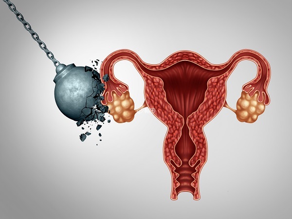 试管前做输卵管造影能提高胚胎着床率