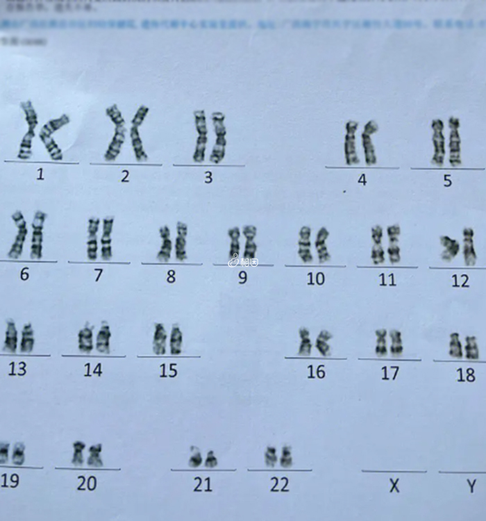 NGS技术可筛查23对染色体
