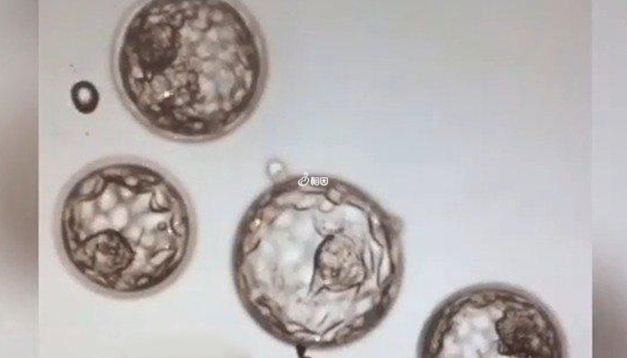10个囊胚筛查出4个