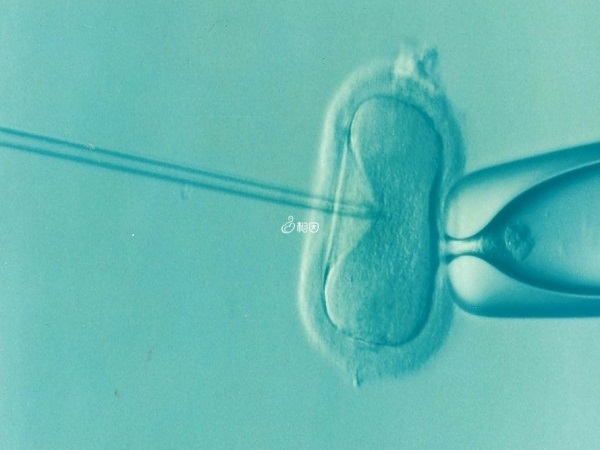 序贯移植一般是在两天内移植两个囊胚