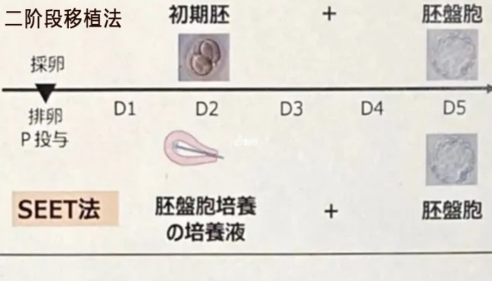 日本有独特的二阶段移植法