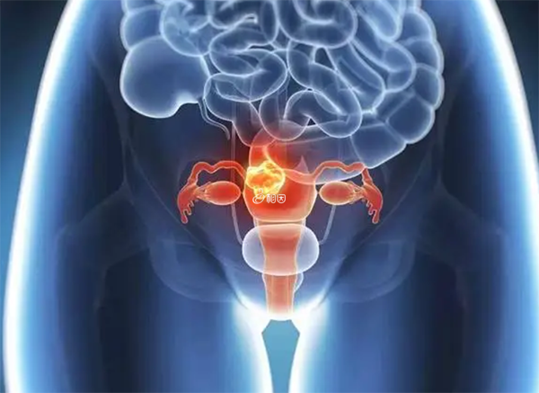 卵巢萎缩会导致排卵障碍