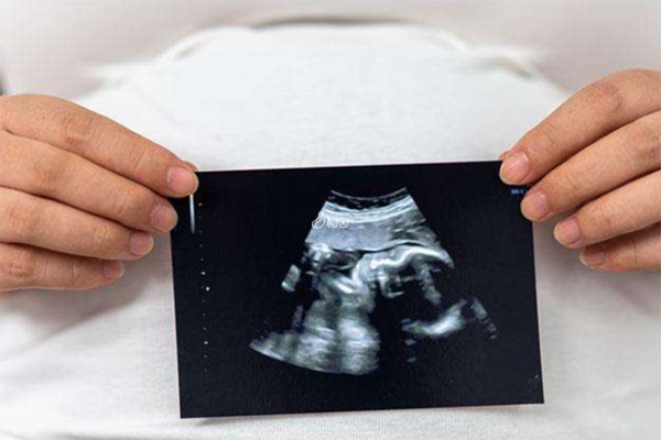 输卵管造影后容易怀孕