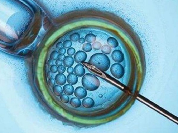 杭州邵逸夫医院供卵做三代试管婴儿要花费7万到16万元之间
