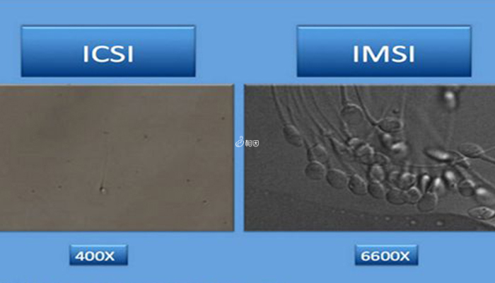 IMSI技术可放大精子6600倍