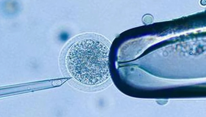 体外受精是采用单精子注射方式