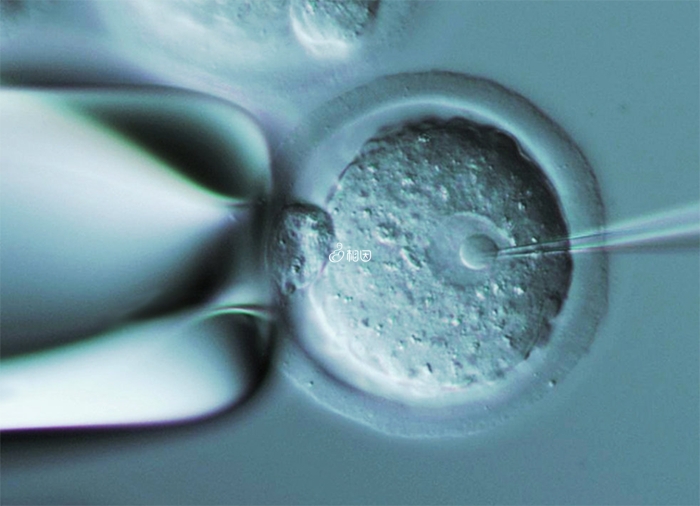 试管促排获9个优质囊胚