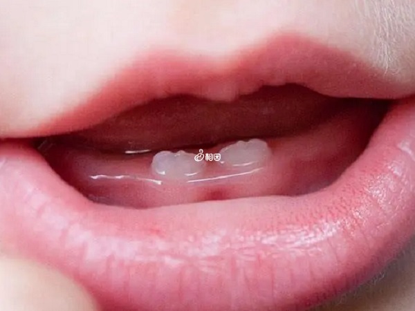 宝宝长牙期间可能会食欲不振