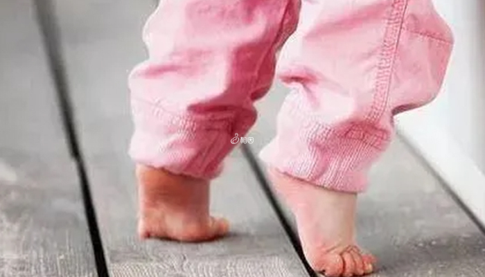 脑瘫孩子是用脚趾走路