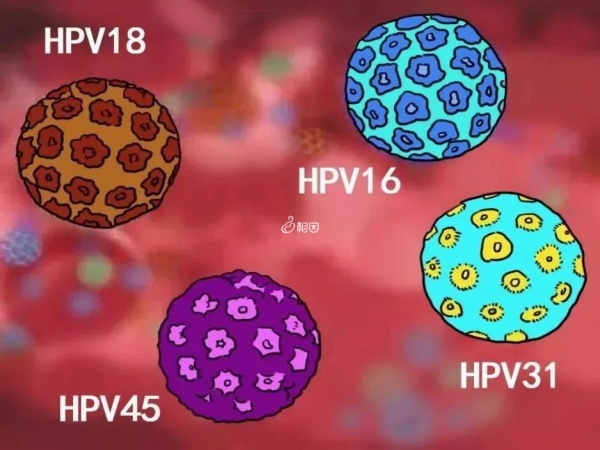 二价疫苗防御HPV16、18型病毒