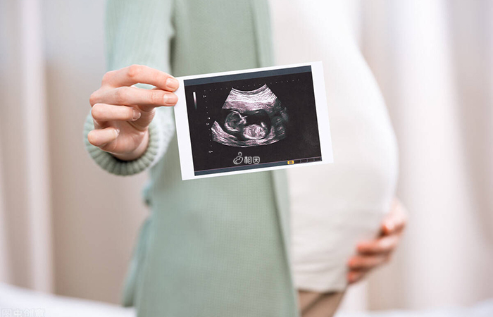 医生会根据早孕期的孕囊大小来推算孕周