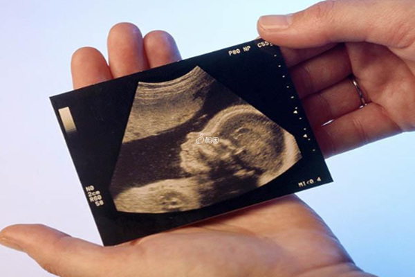 nt检查增厚4.2宝宝有可能顺产出生