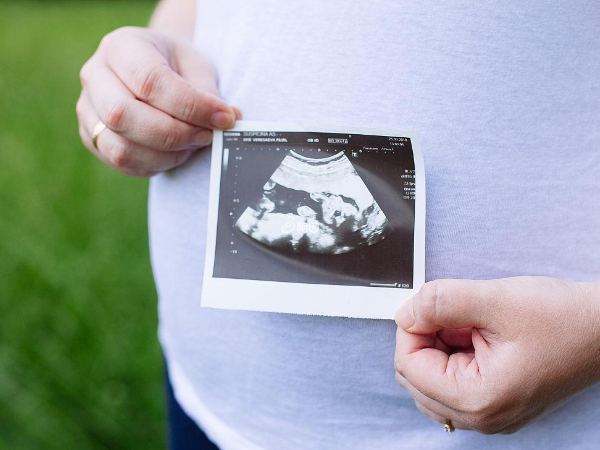孕期胎儿姿势和位置是固定的