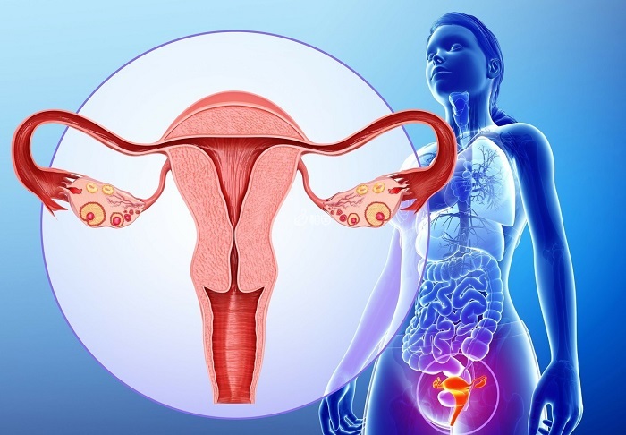 卵巢囊肿是一种常见的妇科疾病