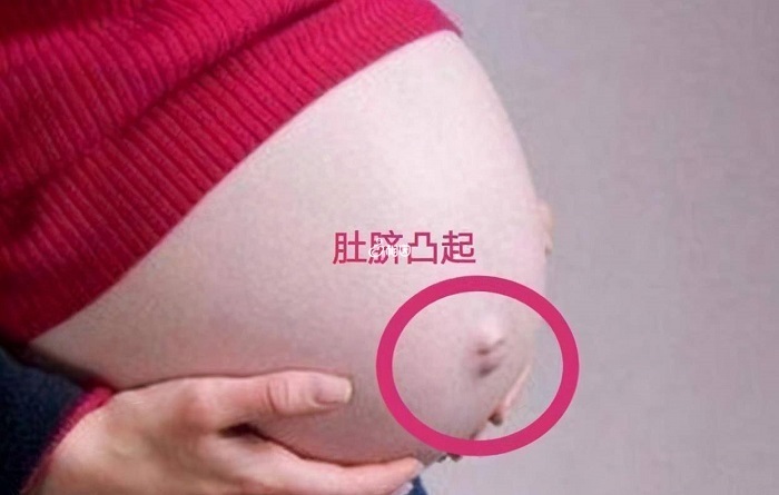 孕妇肚脐眼突出的多半是生女孩