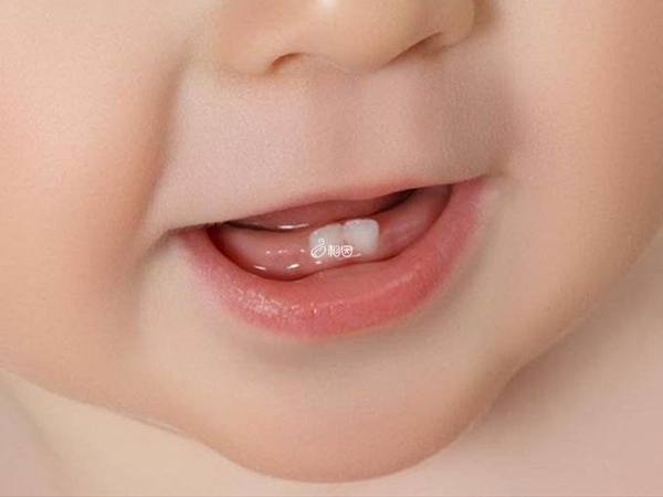 宝宝长单牙是正常现象