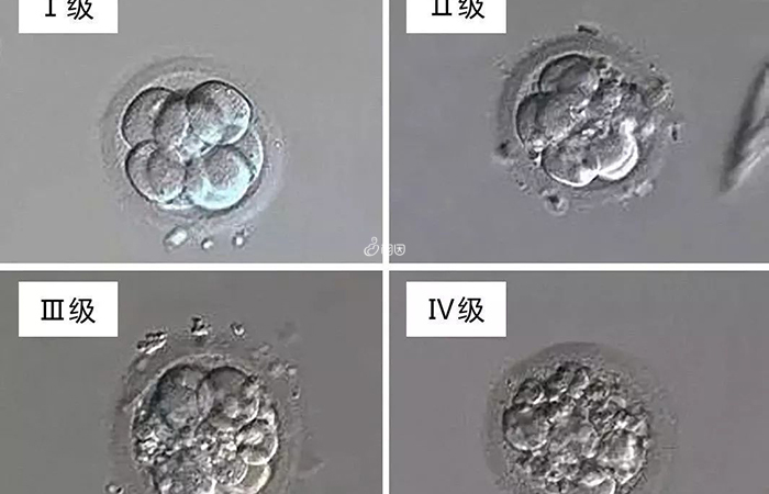 囊胚的质量等级和胚胎性别是没有关系的