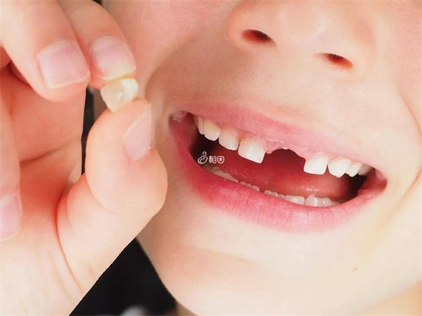 1一6岁的儿童出牙数标准颗数介绍，附年