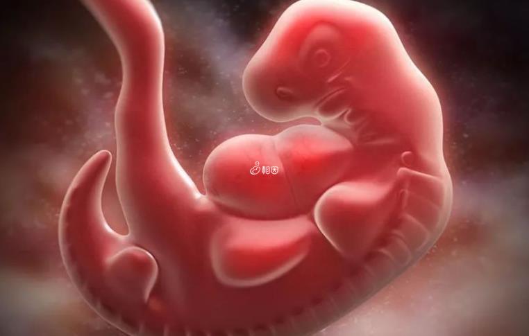 移植两个囊胚只有一个孕囊另外一个去哪里了