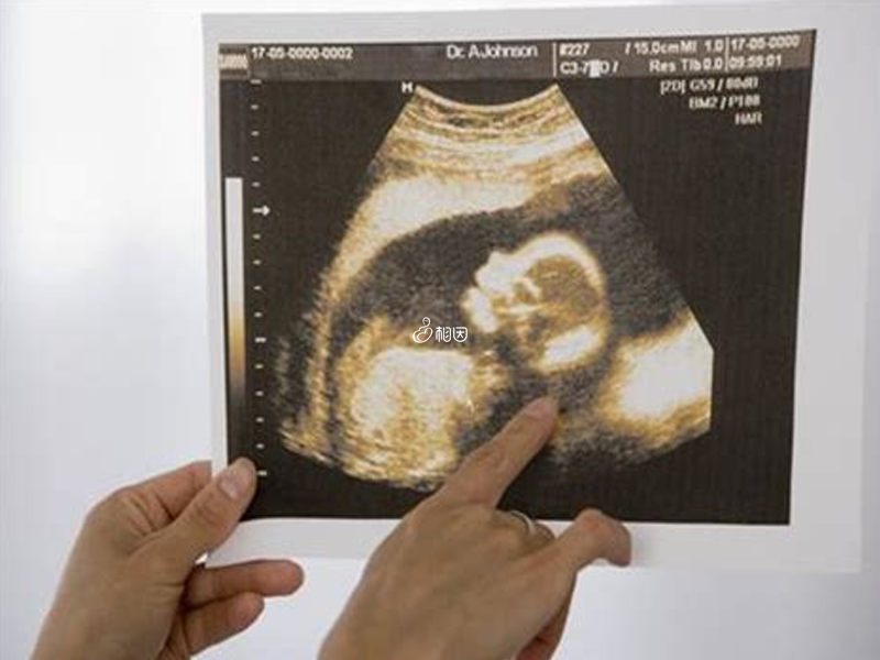 6-7周孕囊大小看男女