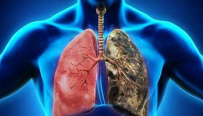 O型血的人肺部容易出现疾病
