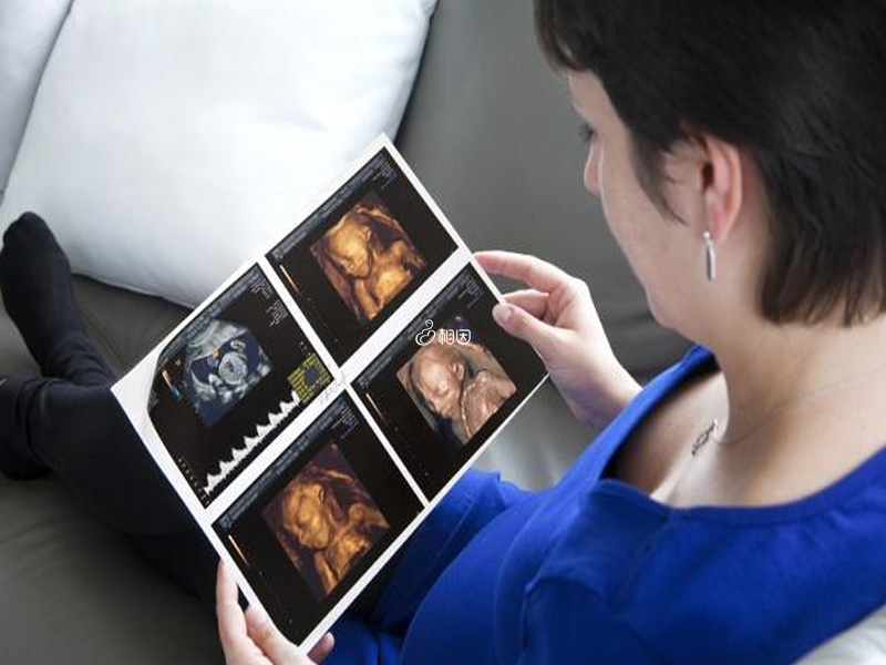 7个月男胎阴囊B超影像