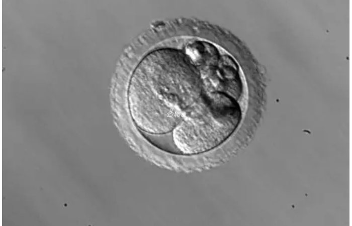 三代试管婴儿筛选出胚胎嵌合体的原因有三个