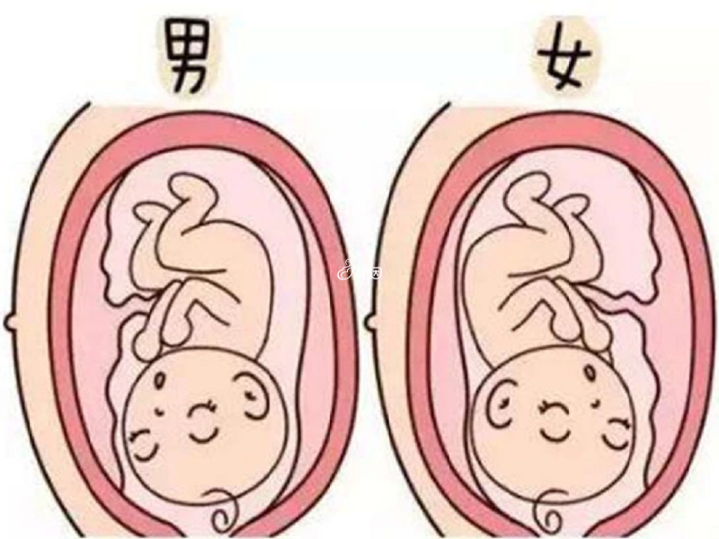 胎盘位置不能判断胎儿男女